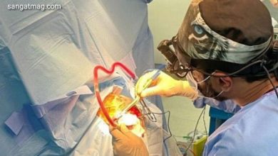 Photo of پاکستانی ڈاکٹروں کا کارنامہ، مریض کو بیہوش کیے بغیر دماغی رسولی کا کامیاب آپریشن