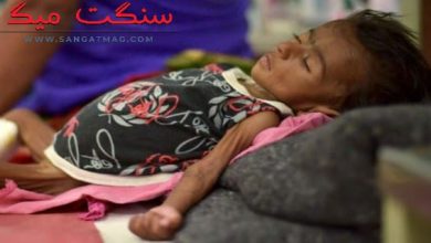 Photo of سندھ کے بچے غذائی قلت، کمزوری اور پست قامت میں سرِفہرست