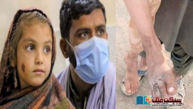 Photo of بلوچستان میں لیشمینیا کے مریضوں میں اضافہ، ’انجکشن کسی کے پاس نہیں‘