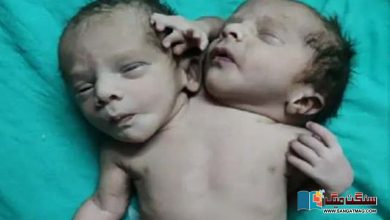 Photo of دو سر اور تین ہاتھوں والے بچے پیدا ہونے کی وجہ کیا ہے،  کیا علاج ممکن ہے؟
