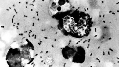 Photo of ڈی این اے سے ماہرین کا سات سو سال قبل آنے والی وبا کا راز حل کرنے کا دعویٰ