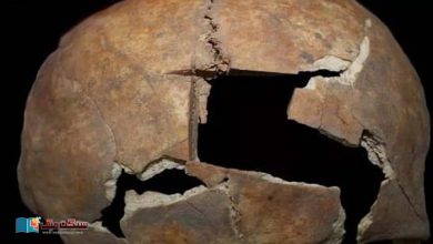 Photo of تین ہزار سال قدیم کھوپڑی پر دماغ کی سرجری کے نشانات کا معمہ
