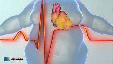 Photo of موٹاپا کی وجوہات کیا ہیں اور یہ کیسے دل کے موذی امراض کی وجہ بنتا ہے؟