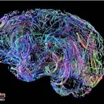 Amazing-changes-in-the-human-brain-after-the-age-of-forty.-How-to-keep-it-healthy-