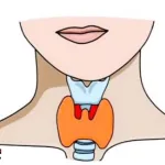 How-does-thyroid-gland-disease-autoimmune-hypothyroidism-affect-us