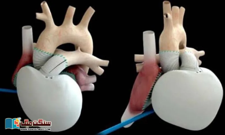 How-long-will-it-take-to-develop-the-perfect-artificial-heart