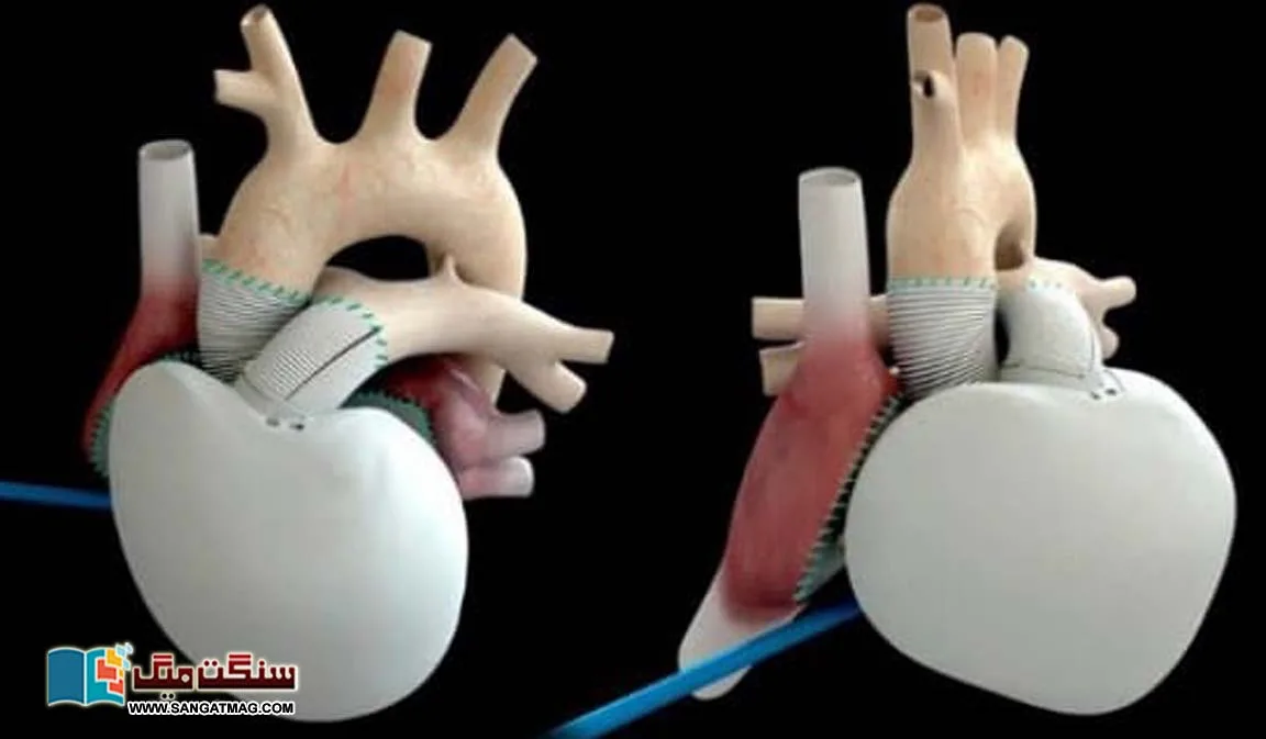 How-long-will-it-take-to-develop-the-perfect-artificial-heart
