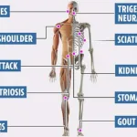 From-boils-on-the-body-to-kidney-stones.-Twenty-Worst-Body-Pains