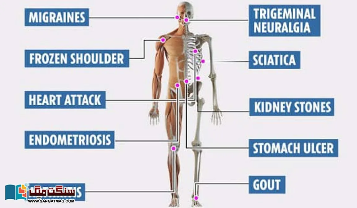 From-boils-on-the-body-to-kidney-stones.-Twenty-Worst-Body-Pains