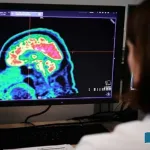successful-treatment-of-a-dangerous-type-of-brain-tumor-has-awakened-new-hope-in-the-future