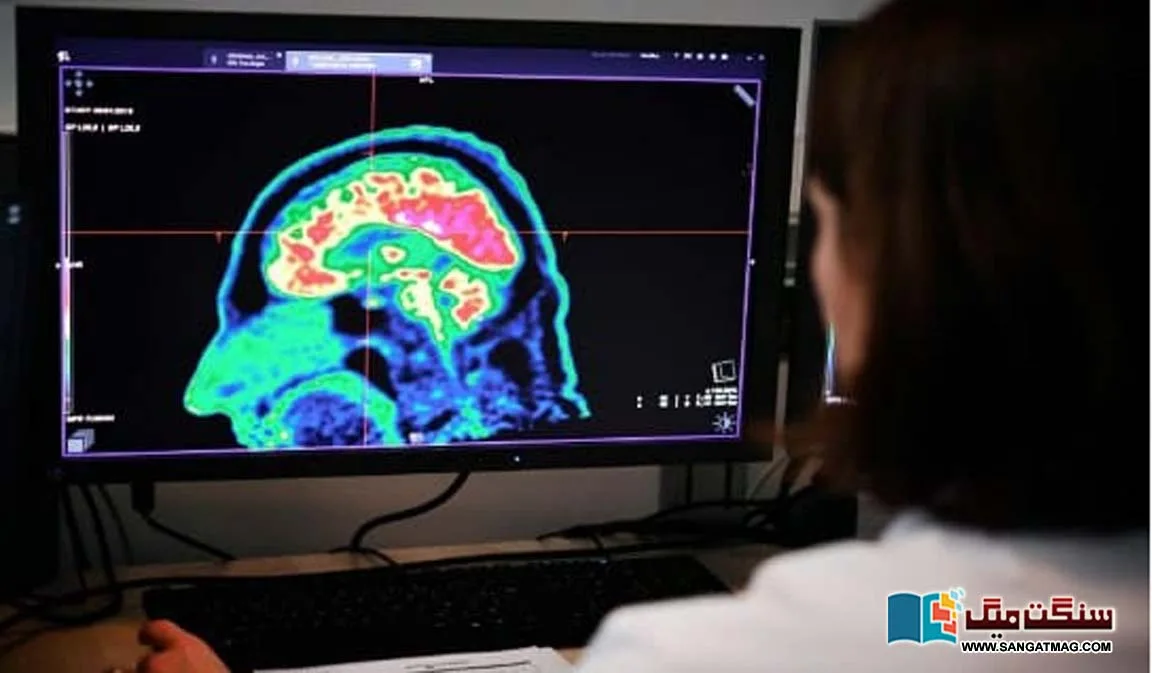 successful-treatment-of-a-dangerous-type-of-brain-tumor-has-awakened-new-hope-in-the-future