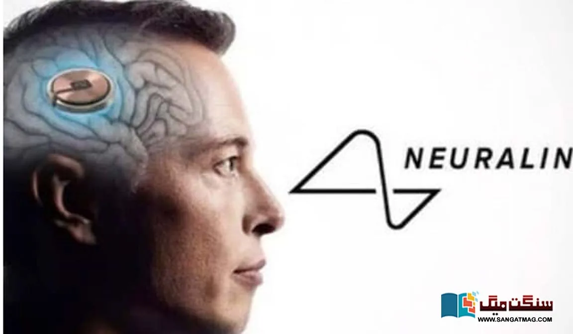 the-first-successful-experiment-of-implanting-a-computer-chip-in-the-human-brain