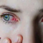 Eye-infections-can-be-more-serious-than-you-realize.-Experts-warn