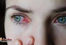 Photo of آنکھوں کے انفیکشن آپ کے احساس سے کہیں زیادہ سنگین ہو سکتے ہیں۔ ماہرین کا انتباہ