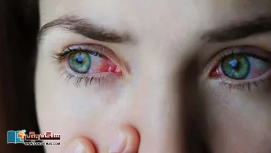Photo of آنکھوں کے انفیکشن آپ کے احساس سے کہیں زیادہ سنگین ہو سکتے ہیں۔ ماہرین کا انتباہ