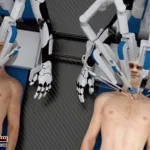 robot-surgeons-perform-human-head-transplants