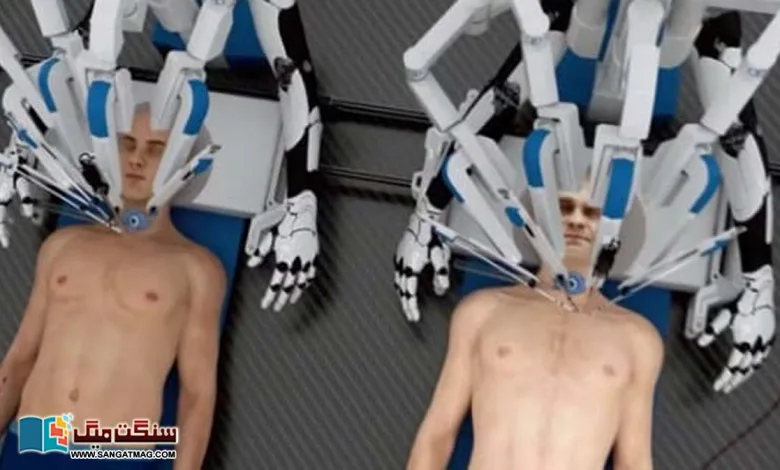 robot-surgeons-perform-human-head-transplants