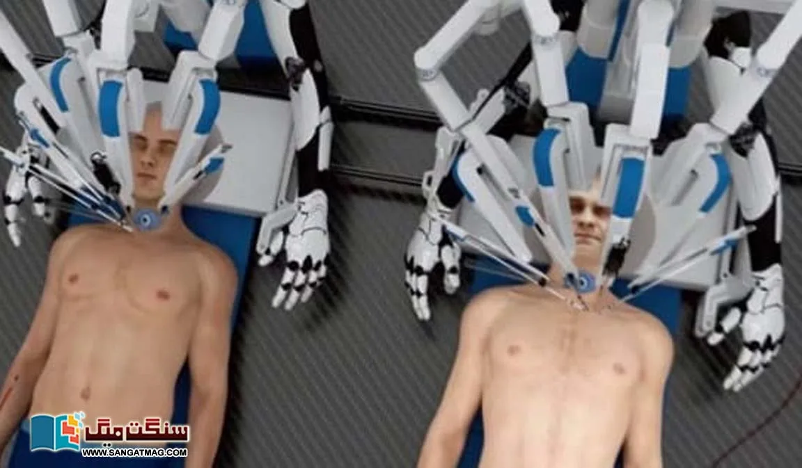 robot-surgeons-perform-human-head-transplants