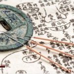 Acupuncture-A-6000-year-old-treatment-method-popularized-in-modern-times