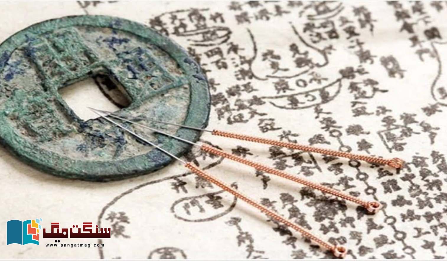 Acupuncture-A-6000-year-old-treatment-method-popularized-in-modern-times